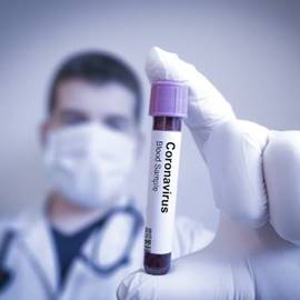 בדיקת מעבדה של נגיף הקורונה - Lab test of the Corona VIrus